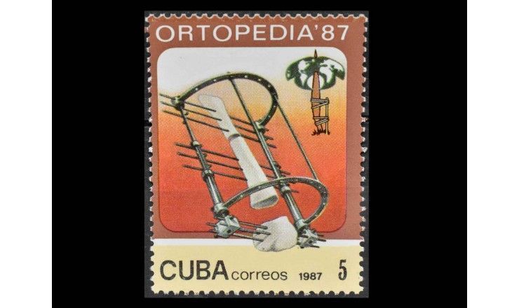 Куба 1987 г. "Ассамблея Ассоциации ортопедов Португалии и Испании ORTOPEDIA '87, Гавана"